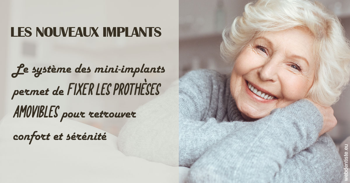 https://dr-brenda-mertens.chirurgiens-dentistes.fr/Les nouveaux implants 1