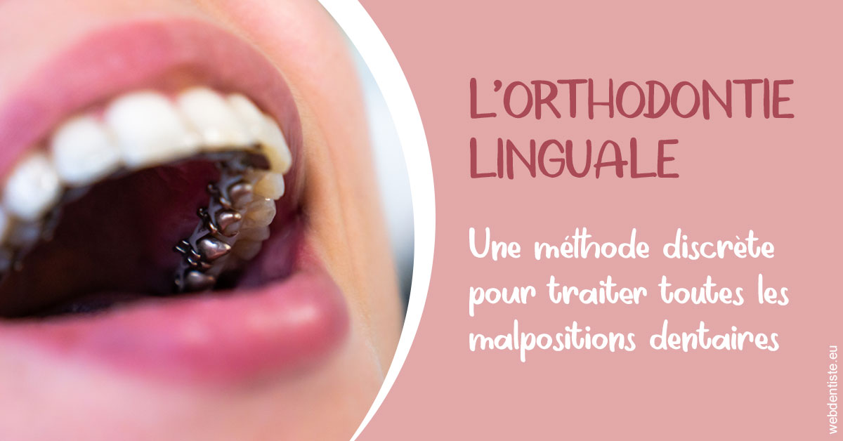 https://dr-brenda-mertens.chirurgiens-dentistes.fr/L'orthodontie linguale 2