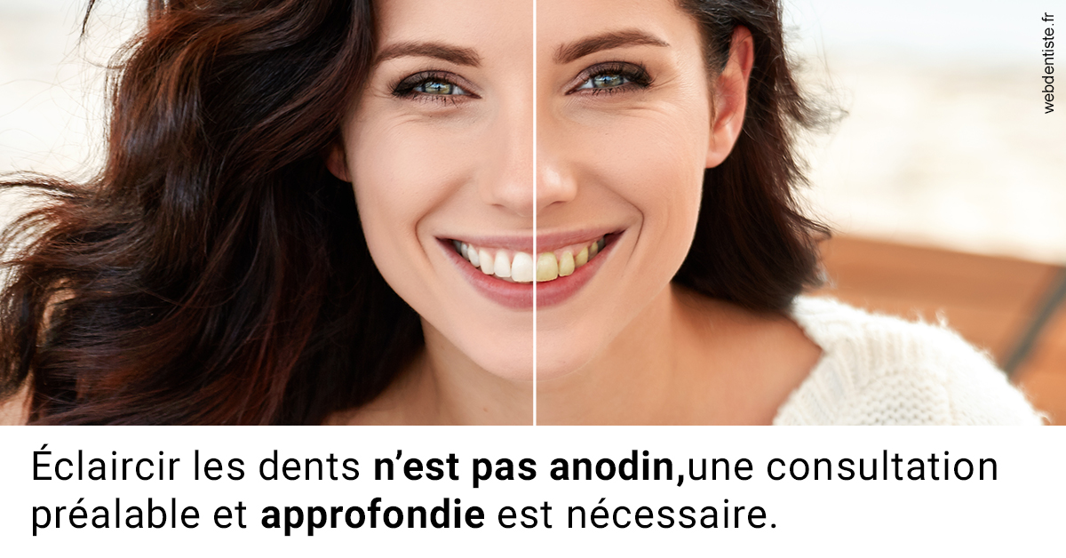 https://dr-brenda-mertens.chirurgiens-dentistes.fr/Le blanchiment 2