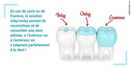 https://dr-brenda-mertens.chirurgiens-dentistes.fr/L'INLAY ou l'ONLAY