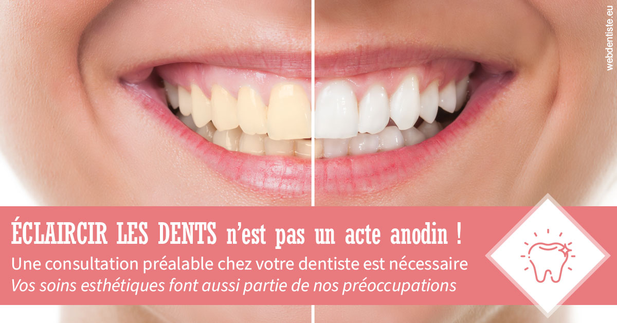 https://dr-brenda-mertens.chirurgiens-dentistes.fr/Eclaircir les dents 1
