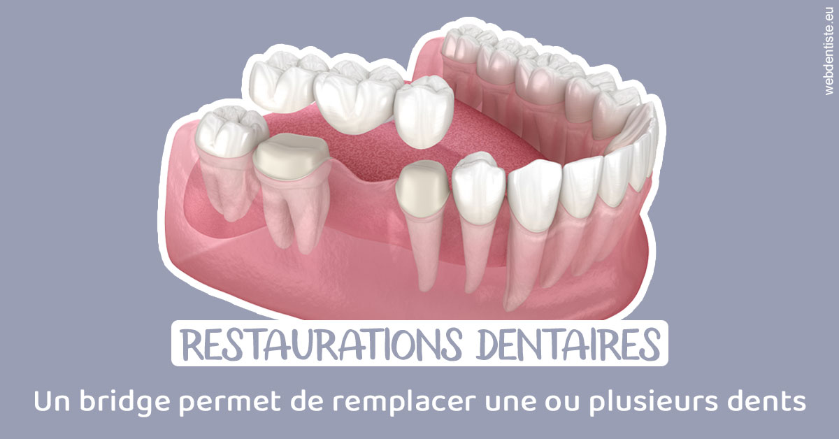https://dr-brenda-mertens.chirurgiens-dentistes.fr/Bridge remplacer dents 1