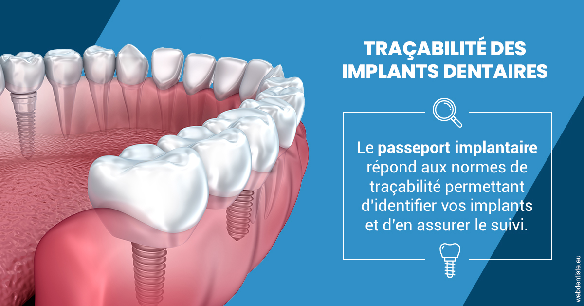 https://dr-brenda-mertens.chirurgiens-dentistes.fr/T2 2023 - Traçabilité des implants 1