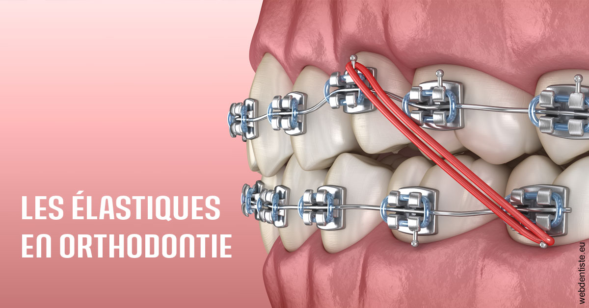 https://dr-brenda-mertens.chirurgiens-dentistes.fr/Elastiques orthodontie 2
