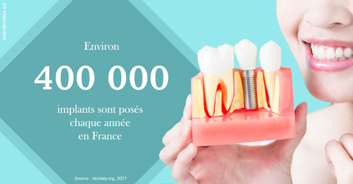 https://dr-brenda-mertens.chirurgiens-dentistes.fr/Pose d'implants en France 2